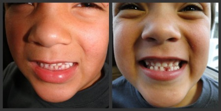 Sam's Tooth Collage